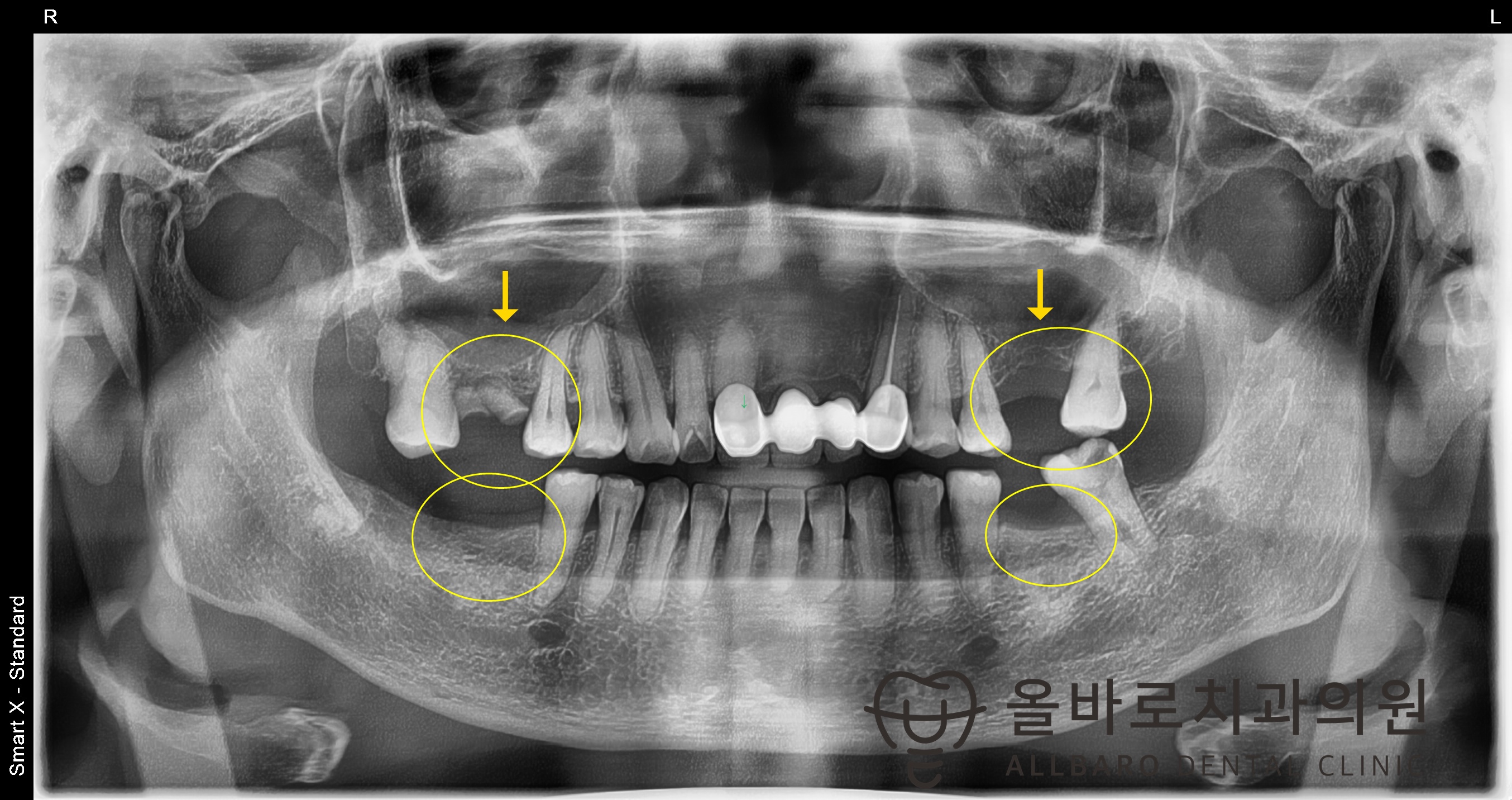 올바로치과 치료 기록 이미지